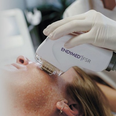 Fraktsioon RF noorendus Endymed FSR