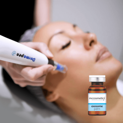 PDRN eksosoomid DERMAPEN-mikronõelumisega