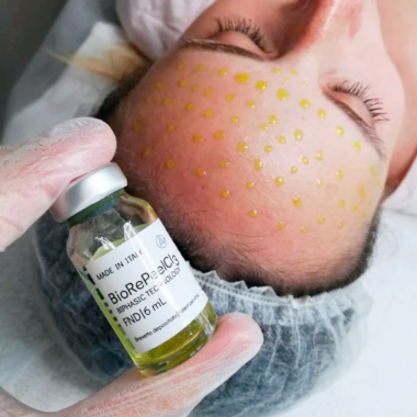 BioRePeelCl3 Nõelavaba biorevitalisatsioon