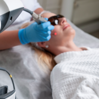 Fraktsionaalne lasernoorendus Q SWITCH